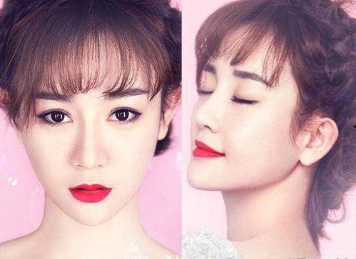 下巴整形照片,术前术后对比照片解析